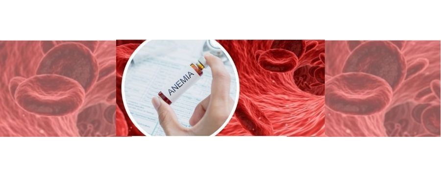 Anemia