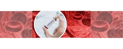 Anemia
