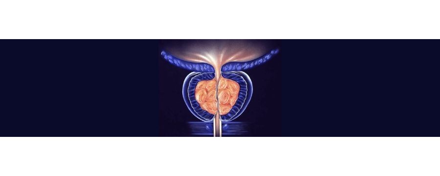 Prostata